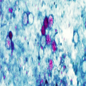 Cyclospora